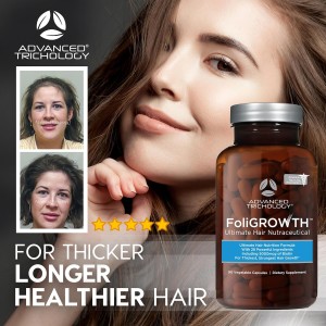 ضخیم کننده و پرپشت کننده گیاهی موهای نازک مدل foligrowth