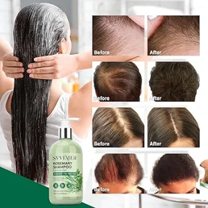 شامپورزماری ضد ریزش حجم دهنده رشد مجدد مو Biotin Infused
