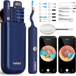 دستگاه آندوسکوپی و پاک کننده داخل گوش شیائومی مدل Xiaomi I35R