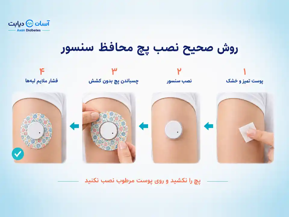 نحوه نصب چسب اضافی سنسور قند خون