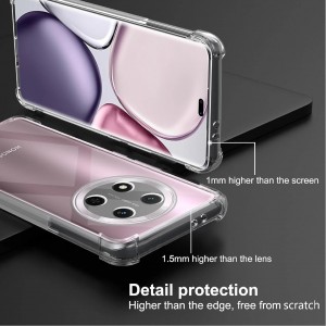 قاب شفاف ClearGuard برای آنر Honor X9C، ترکیبی از زیبایی و محافظت؛ بدون زرد شدن، پوشش کامل بدنه و محافظت از دوربین.