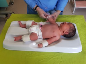 بیبی فیکس Babyfix وسیله ای مناسب برای ثابت نگه داشتن شیرخواران در زمان نمونه گیری های خون در آزمایشگاه های تشخیص طبی است