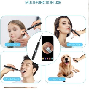 گوش پاک کن هوشمند شیائومی  Xiaomi  Bebird R1 در بروزکالا