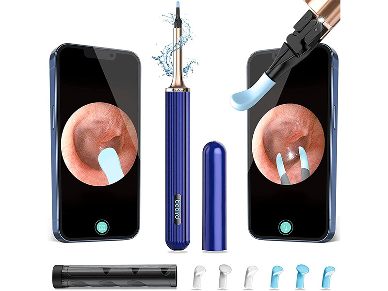 گوش پاک کن هوشمند شیائومی  Xiaomi Bebird Note 3 Pro 3 in 1 multifunctional earwax removal
