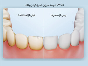 خرید دستگاه شست و شوی دهان و دندان