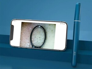 دستگاه پاک کننده صورت هوشمند شیائومی Xiaomi Youpin Wisdom Intelligent Visible Pore Cleaner