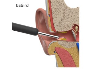 دستگاه آندوسکوپی و پاک کننده داخل گوش شیائومی Xiaomi Bebird R1 Smart Visual Ear Sticks Endoscope