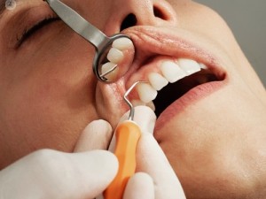 متخصص و دکتر آبسه دندان در اصفهان