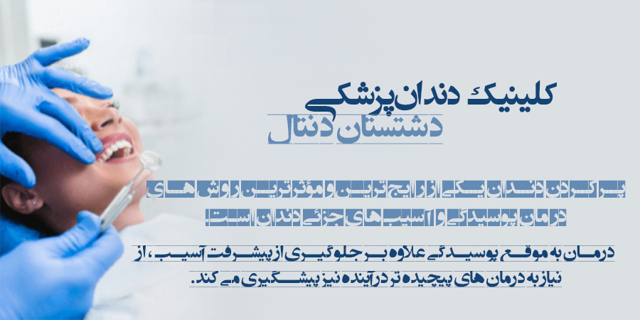 پر کردن دندان چیست و چگونه انجام می شود - کلینیک دندانپزشکی اصفهان