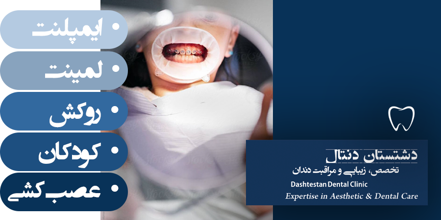 خدمات دندانپزشکی - دشتستان دنتال