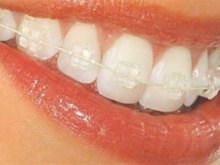 نسخه ابوعلی سینا برای داشتن دندانهای زیبا و لثه سالم