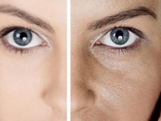 بازسازی صورت با روشی مدرن