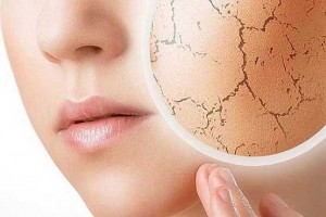 آلودگی هوا با پوست چه می‌کند؟
