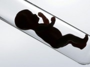 درمان ناباروری با روش IVF چیست؟