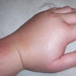 وقتی بدن آب و نمک قاطی میکند (مطلب)
