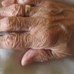 اگر از چین و چروک دست هایتان گریزانید بخوانید (مطلب)