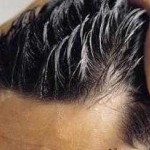 دلایل چرب شدن موی سر و راههای کاهش آن
