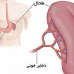 چرا طحال بزرگ می‌شود؟ + عوارض و علائم