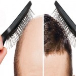 ۴۰ دلیل شایع ریزش مو + راهکار‌های درمانی