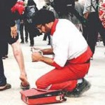 درمان تاول‌ های زائران اربعین با روش سنتی