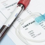 آنچه باید درباره هیپرلیپیدمی یا چربی خون بالا بدانید