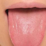10 علت شایع گزگز نوک زبان