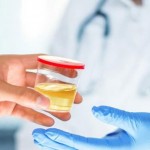 بررسی کامل آنوریا یا بی ادراری