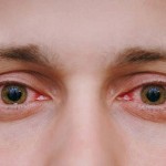 این علایم در چشم ها نشانه چیست؟