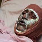 قطع عضو و کوری از عوارض حوادث چهارشنبه آخر سال