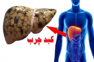 کبدچرب