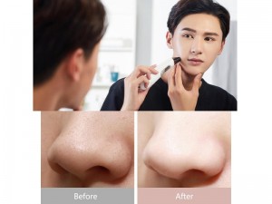 دستگاه پاک کننده جوش سرسیاه شیائومی مدل Wellskins WX-HT100 Electric Blackhead Cleaner