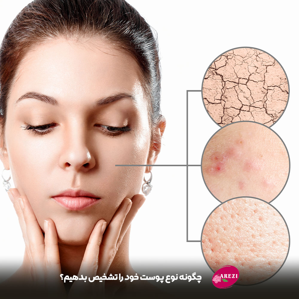 چگونه میتوانیم تشخیص دهیم که پوست ما از چه نوعی است؟