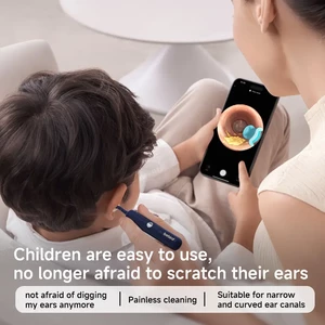 گوش پاک کن هوشمند شیائومی مدل Bebird I35R