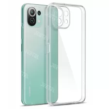 قاب گوشی Xiaomi MI 11 Lite مدل تمام ژله ای محافظ لنزدار