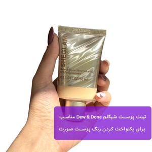 تینت پوست شیگلم