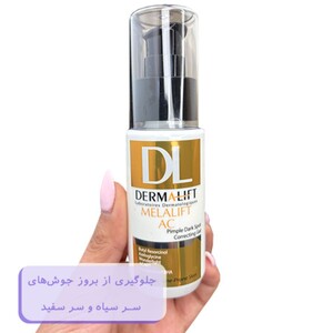 ژل روشن کننده ملالیفت AC درمالیفت