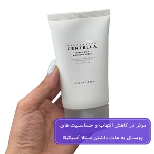 کرم مرطوب کننده سنتلا پوست خشک