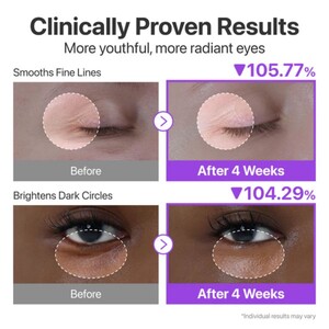کرم دور چشم نامبوزین شماره 9 حاوی رتینول و پپتاید 10ml