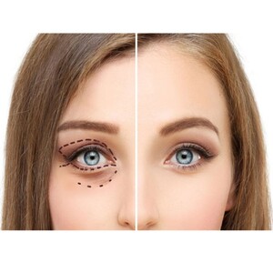 ژل کرم دور چشم آردن سی فکتور