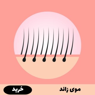 موی زائد