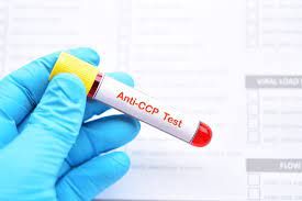 دانلود کتاب تفسیر تست های crp RF anticcp