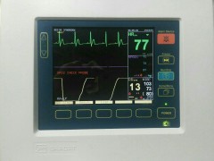 مانیتور علائم حیاتی سعادت S630