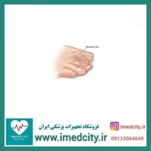 لاانگشتی هَمِر تو طب و صنعت کد 10800