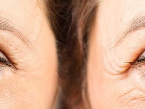 چطوري پوستي صاف و بدون چروك داشته باشيم؟