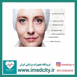 درمارولر (میکرونیدلینگ خانگی دستی )