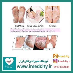 جوراب ترک پا سیلیکونی فانتزی