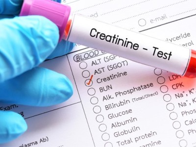 راه‌کارهایی کاربردی برای کاهش سطح کراتین خون