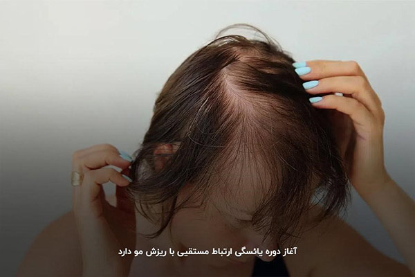 یائسگی؛&zwnj; مهم&zwnj;ترین علت ریز مو در زنان میانسال