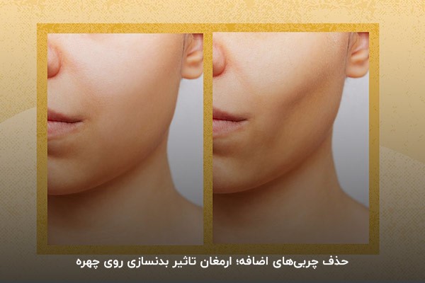 ورزش بدنسازی؛ حذف کننده چربی&zwnj;های اضافه صورت