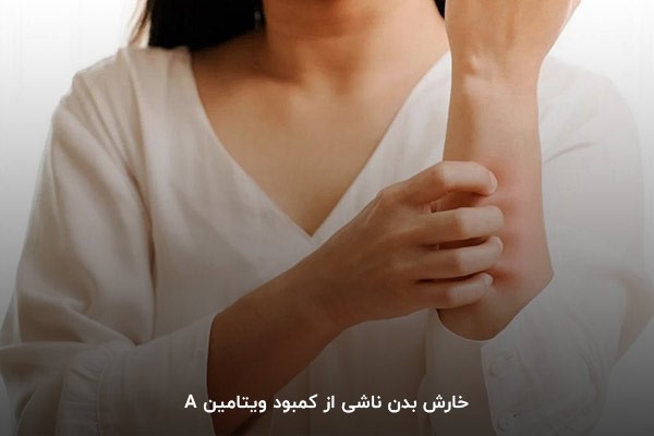 خارش بدن؛ یکی از نشانههای کاهش ویتامین A